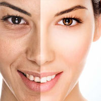 anti aging creams
